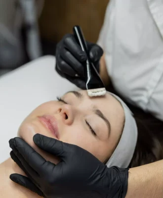 facial-acne-treatment